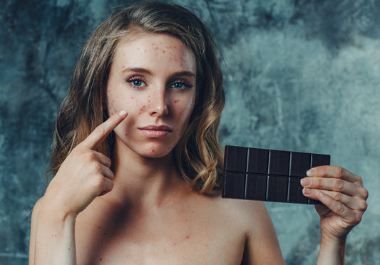 Does Diet Affect Acne and Spots?