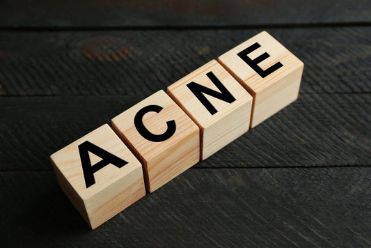 Top Acne Tips