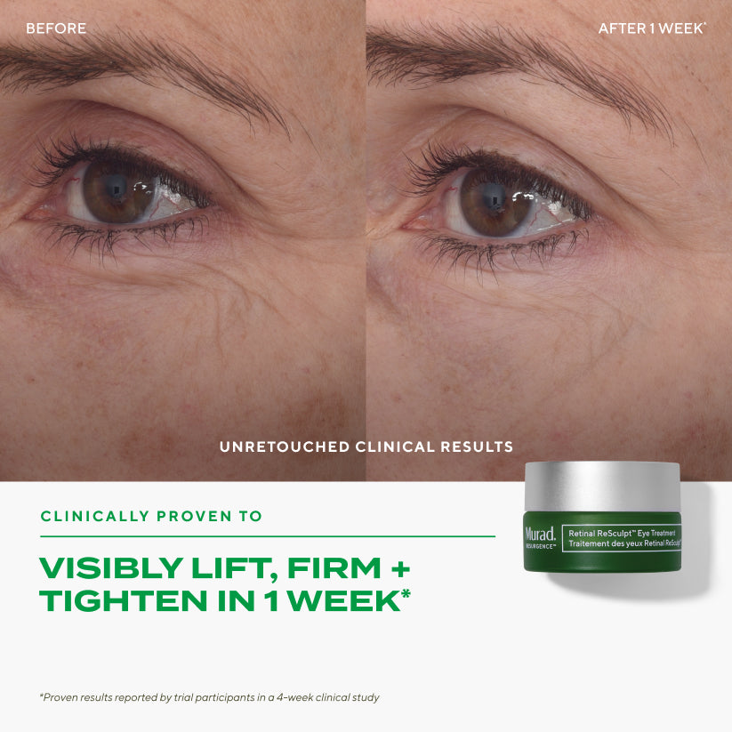 Murad Retinal ReSculpt™ Eye Treatment 15ml