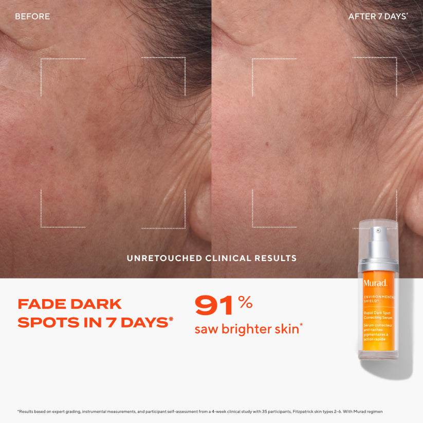 Murad Rapid Dark Spot Correcting Serum