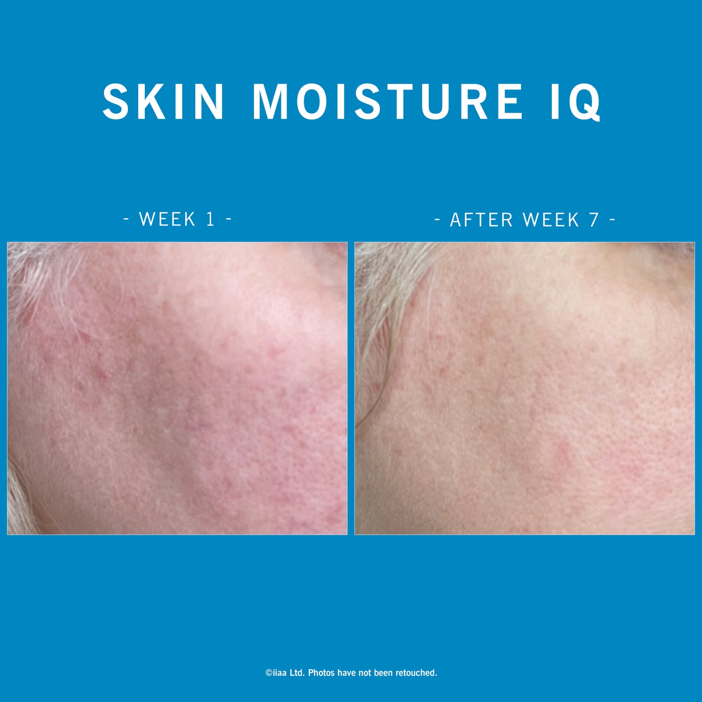Advanced Nutrition Programme Skin Moisture IQ