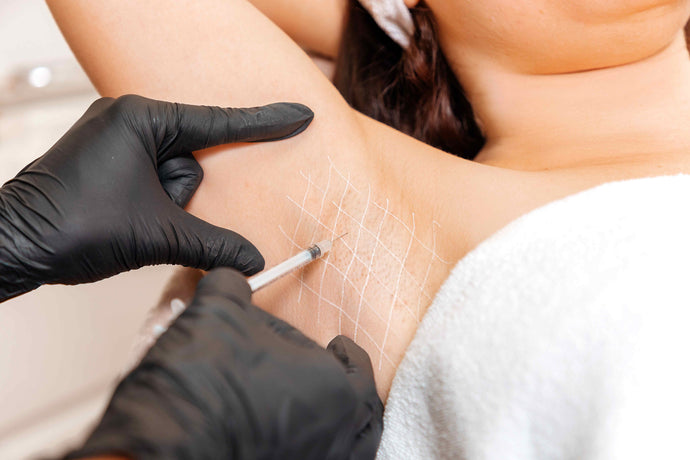 How does Botox work for hyperhidrosis?