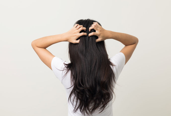 DANDRUFF VERSUS DRY SCALP – WHAT'S THE DIFFERENCE?