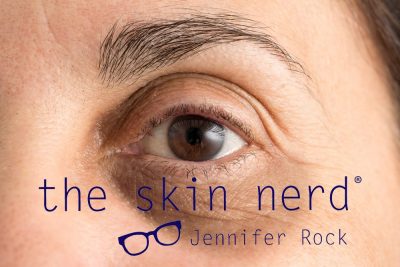 Dark Circles: The Causes And How To Treat