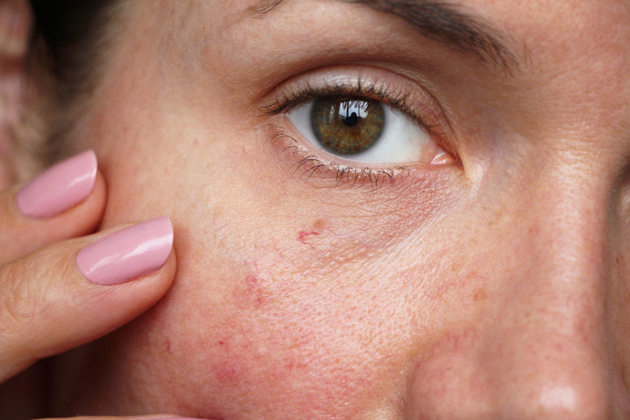 What Does Sensitive Skin Really Mean?