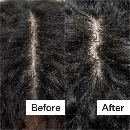 Act+Acre Cold Processed Scalp Detox
