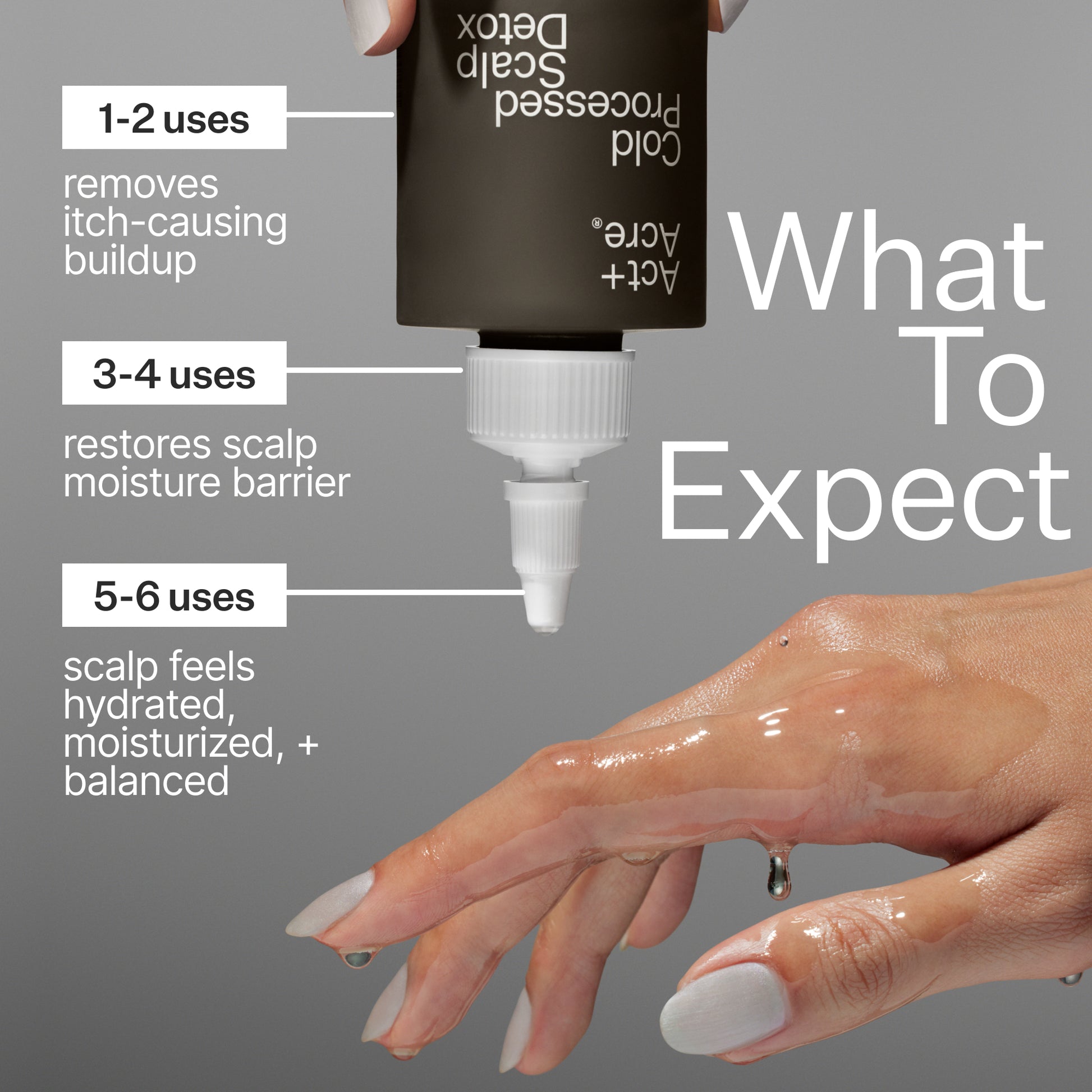 What to Except
