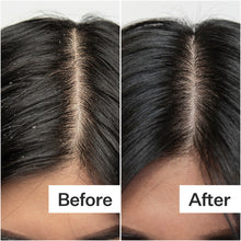 Load image into Gallery viewer, Act+Acre Salicylic Acid Scalp Exfoliator
