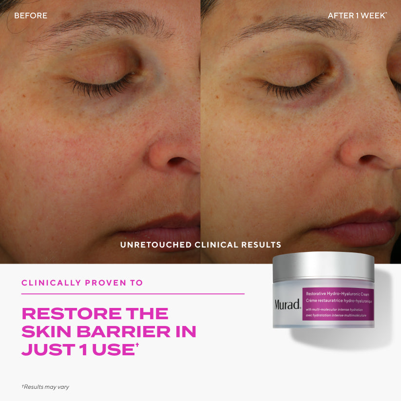 Murad Restorative Hydro-Hyaluronic Cream