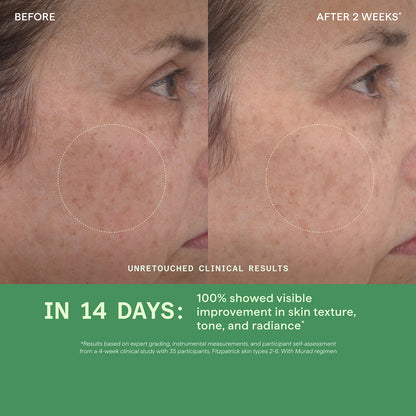 Retinol Youth Renewal Serum