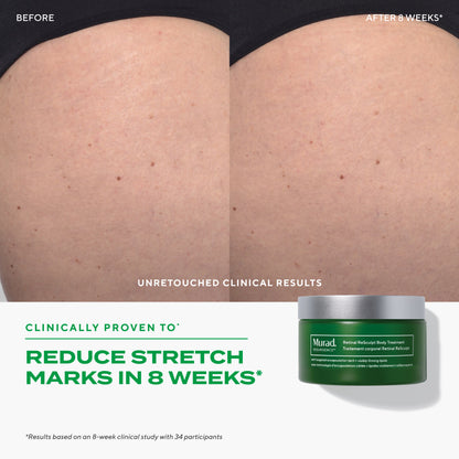 Murad Retinal ReSculpt™ Body Treatment