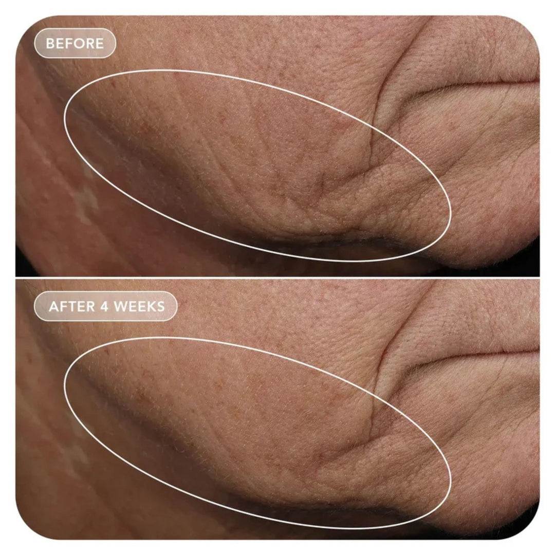 IMAGE Skincare VOL.U.LIFT™ Skin Rebound Complex 57ml