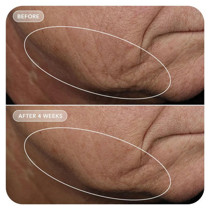 IMAGE Skincare VOL.U.LIFT™ Skin Rebound Complex 57ml
