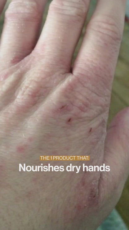 Advanced Nutrition Programme Skin Omegas 180 + COMPLIMENTARY Skin Vit A