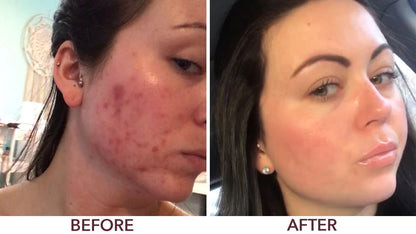 Doll 10 Smooth Assist Overnight Facial Resurfacing Serum