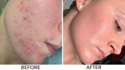 Doll 10 Smooth Assist Overnight Facial Resurfacing Serum