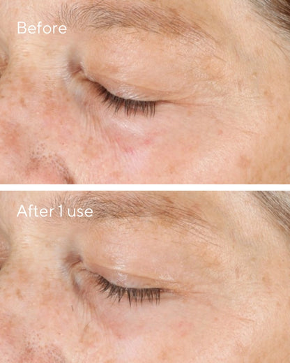 Murad ES Vita-C Triple Resurfacing Facial